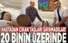 Hastadan çıkan taşları sayamadılar! 20 binin üzerinde...