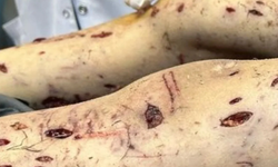 Başıboş köpeklerin saldırdığı küçük Tunahan'ın vücudu paramparça: Yaşam savaşı veriyor