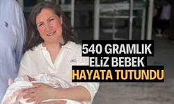 540 gramlık Eliz bebek hayata tutundu
