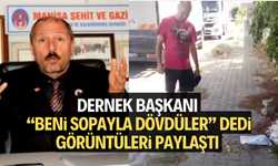 Dernek Başkanı 'Beni sopayla dövdüler' dedi, görüntüleri paylaştı