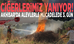 Ciğerlerimiz yanıyor! Akhisar’da alevlerle mücadelede 3. gün