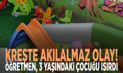 Kreşte akılalmaz olay! Öğretmen, 3 yaşındaki çocuğu ısırdı