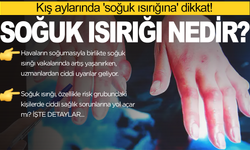 Kış aylarında 'soğuk ısırığına' dikkat! Tedavi edilmezse ne olur?