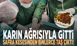 Karın ağrısıyla gitti, safra kesesinden binlerce taş çıktı!