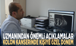 Uzmanından önemli açıklamalar... Kolon kanserinde kişiye özel dönem