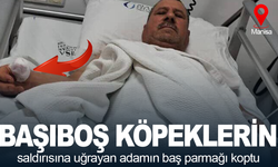 Başıboş köpeklerin saldırısına uğrayan adamın baş parmağı koptu