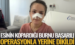 Eşinin kopardığı burnu başarılı operasyonla yerine dikildi