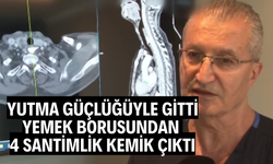 Yutma güçlüğüyle gitti, yemek borusundan 4 santimlik kemik çıktı