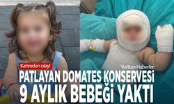 Kahreden olay! Patlayan domates konservesi 9 aylık bebeği yaktı