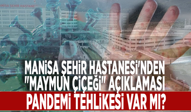 Manisa Şehir Hastanesi'nden "Maymun Çiçeği" açıklaması: Pandemi tehlikesi var mı?"