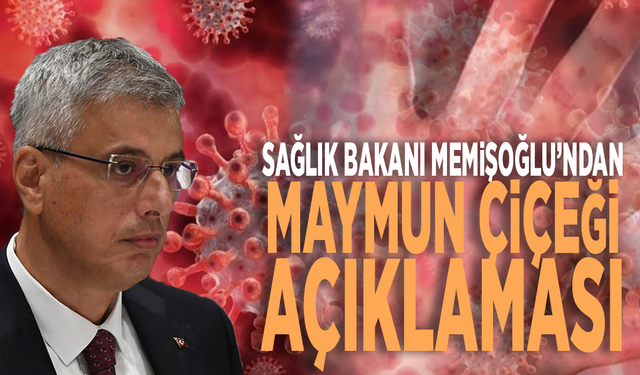 Sağlık Bakanı Kemal Memişoğlu’ndan maymun çiçeği açıklaması