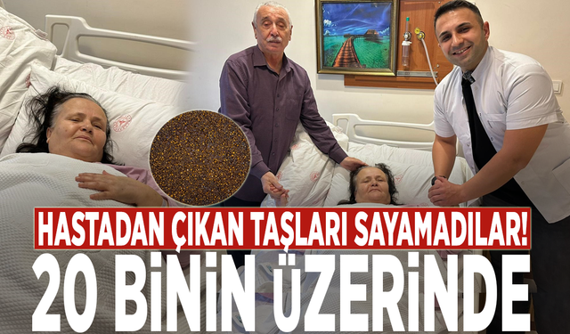 Hastadan çıkan taşları sayamadılar! 20 binin üzerinde...