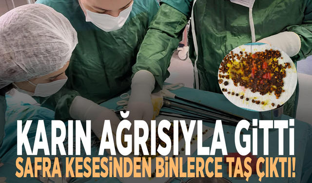 Karın ağrısıyla gitti, safra kesesinden binlerce taş çıktı!