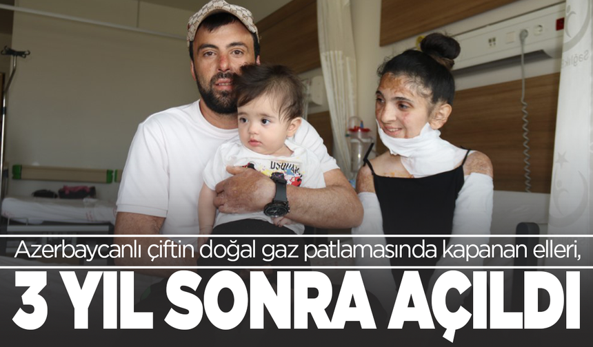 Doğal gaz patlamasında elleri kapanan çift  3 yıl sonra el ele tutuştu