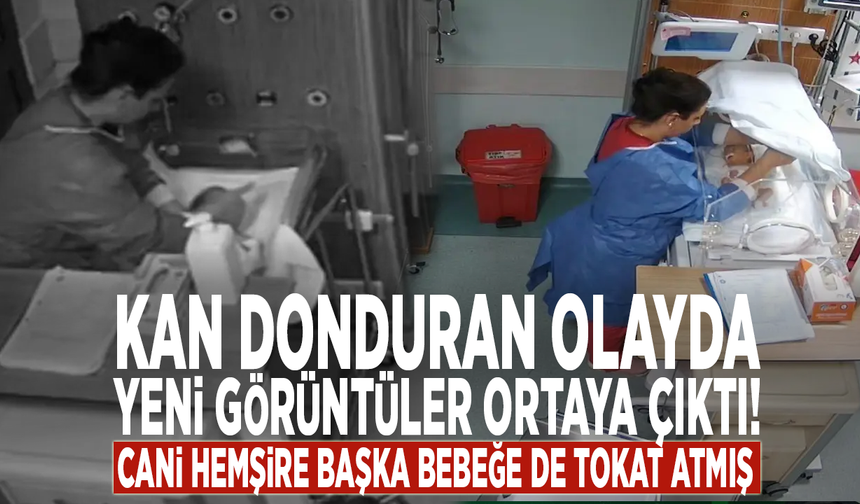 Kan donduran olayda yeni görüntüler ortaya çıktı! Cani hemşire başka bebeğe de tokat atmış