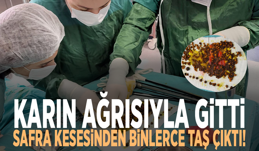 Karın ağrısıyla gitti, safra kesesinden binlerce taş çıktı!