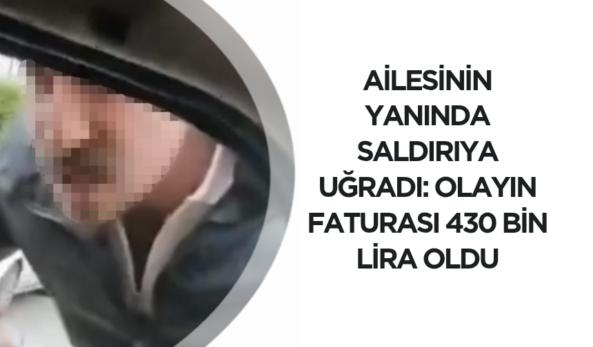 Ailesinin yanında saldırıya uğradı: Olayın faturası 430 bin lira oldu