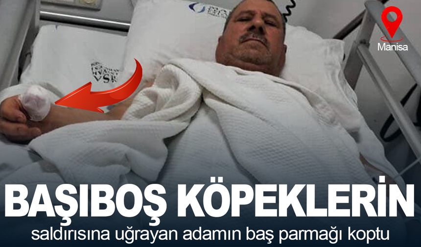 Başıboş köpeklerin saldırısına uğrayan adamın baş parmağı koptu