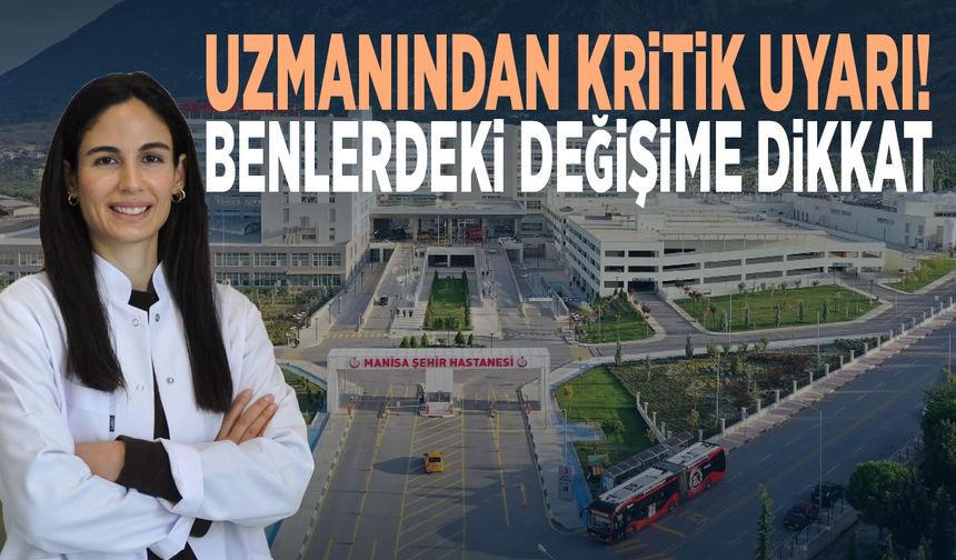 Uzmanından kritik uyarı! Benlerdeki değişime dikkat