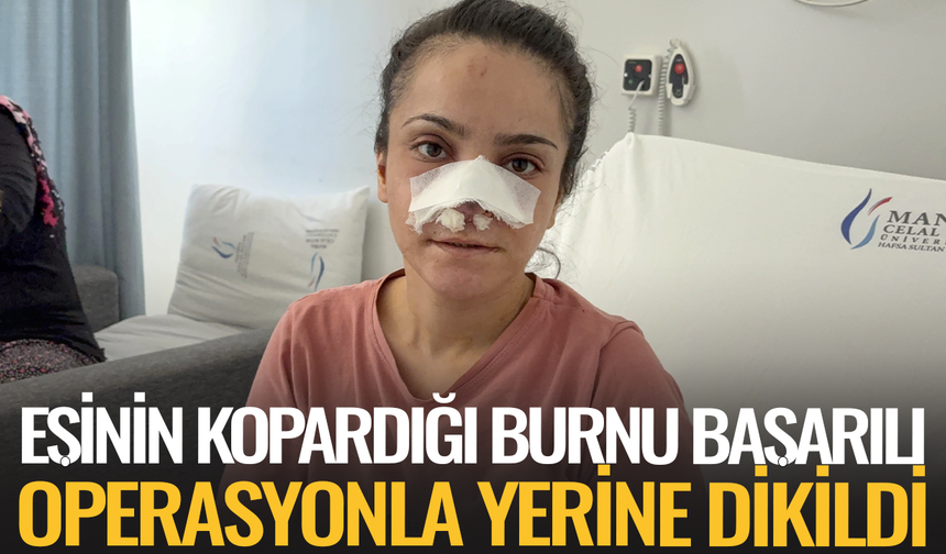 Eşinin kopardığı burnu başarılı operasyonla yerine dikildi