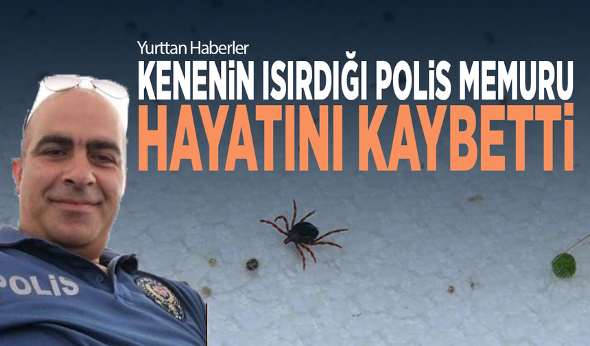 Kenenin ısırdığı polis memuru hayatını kaybetti