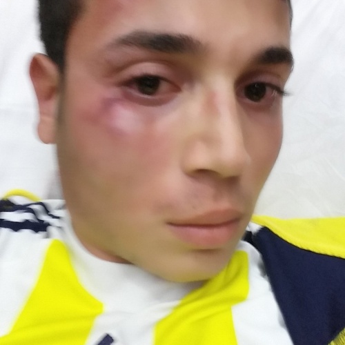 Dokuz Eylül Üniversitesi İktisadi ve İdari Bilimler Fakültesi öğrencisi olan 18 yaşındaki Ömer Eşmekaya arasındaki ilginç olay tedavi gördükleri hastanede gelişti.